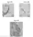 Fig. 13 - Small mobile stem cells (SMS) and uses thereof