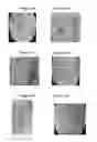 Fig. 15 - Small mobile stem cells (SMS) and uses thereof