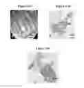Fig. 16 - Small mobile stem cells (SMS) and uses thereof