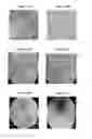 Fig. 17 - Small mobile stem cells (SMS) and uses thereof