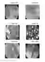 Fig. 18 - Small mobile stem cells (SMS) and uses thereof