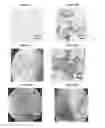 Fig. 19 - Small mobile stem cells (SMS) and uses thereof