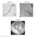 Fig. 20 - Small mobile stem cells (SMS) and uses thereof