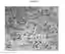 Fig. 23 - Small mobile stem cells (SMS) and uses thereof