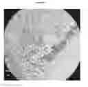Fig. 28 - Small mobile stem cells (SMS) and uses thereof