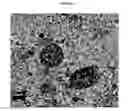 Fig. 31 - Small mobile stem cells (SMS) and uses thereof