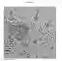 Fig. 33 - Small mobile stem cells (SMS) and uses thereof