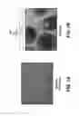 Fig. 02 - Chemical differentiation of pluripotentstem cells into retinal epithelial cells