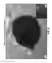 Fig. 04 - Chemical differentiation of pluripotentstem cells into retinal epithelial cells