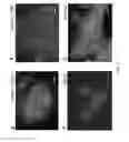 Fig. 11 - Differentiation of pluripotent stem cells and cardiac progenitor cells into striated cardiomyocyte fibers using laminins LN-511, LN-521 and LN-221