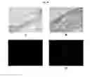 Fig. 11 - ENGINEERED THREE-DIMENSIONAL SKIN TISSUES, ARRAYS THEREOF, AND METHODS OF MAKING THE SAME