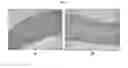 Fig. 14 - ENGINEERED THREE-DIMENSIONAL SKIN TISSUES, ARRAYS THEREOF, AND METHODS OF MAKING THE SAME