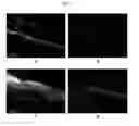 Fig. 16 - ENGINEERED THREE-DIMENSIONAL SKIN TISSUES, ARRAYS THEREOF, AND METHODS OF MAKING THE SAME