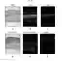 Fig. 20 - ENGINEERED THREE-DIMENSIONAL SKIN TISSUES, ARRAYS THEREOF, AND METHODS OF MAKING THE SAME