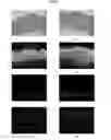Fig. 29 - ENGINEERED THREE-DIMENSIONAL SKIN TISSUES, ARRAYS THEREOF, AND METHODS OF MAKING THE SAME