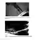 Fig. 03 - Methods for treating glycogen storage disease type IV usng lysosomal acid alpha-glucosidase