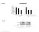 Fig. 04 - SiRNA targeting HSR1