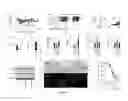 Fig. 02 - METHODS OF TREATING ATHEROSCLEROSIS