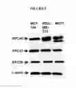 Fig. 05 - Replication factor C-40 (RFC40/RFC2) as a prognostic marker and target in estrogen positive and negative and triple negative breast cancer