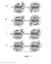 Fig. 03 - A METHOD FOR PRODUCING PRECISE DNA CLEAVAGE USING CAS9 NICKASE ACTIVITY
