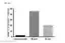 Fig. 13 - Methods for transduction and cell processing