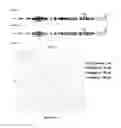 Fig. 02 - Probe for detecting and/or quantifying methylation of the promoter of the IGFBP-3 gene