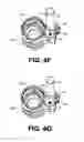 Fig. 14 - Adaptation of flush valve for dual flush capability