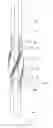Fig. 01 - Reamer for use in drilling operations
