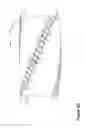 Fig. 07 - Reamer for use in drilling operations