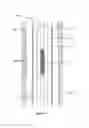 Fig. 16 - Sealing a bore or open annulus