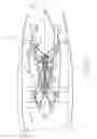Fig. 02 - PASSIVE CONTROL OF GAS TURBINE CLEARANCES USING CERAMIC MATRIX COMPOSITES INSERTS