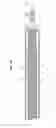 Fig. 03 - Actuation device for moving a movable cowling of a thrust-reverser