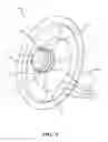 Fig. 04 - Variable turbine geometry turbocharger vane pack retainer
