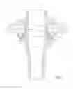 Fig. 04 - Through-hull fitting