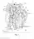 Fig. 02 - Spring retainer including rivets for driving springs in a torque converter damper
