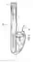 Fig. 03 - Methods and systems for delivering an implant using a planetary gear actuation assembly