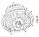 Fig. 17 - Methods and systems for delivering an implant using a planetary gear actuation assembly