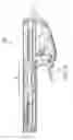 Fig. 04 - Methods and systems for delivering an implant using a planetary gear actuation assembly
