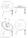 Fig. 61 - Methods and systems for delivering an implant using a planetary gear actuation assembly