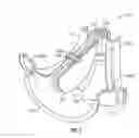 Fig. 04 - Flapper exhaust diverter valve