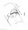 Fig. 04 - METHOD AND APPARATUS FOR INSTALLTION AND REPAIR OF PIPE SYSTEMS