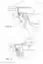 Fig. 06 - Wrist strap for the barrel of a firearm