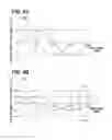 Fig. 05 - Rotation angle and stroke amount detection device