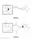 Fig. 02 - Method and device for detecting a slow leak in an implantable hydraulic occlusion system