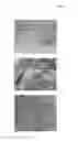 Fig. 10 - Method, systems and kit for forensic identification, post mortem interval estimation and cause of death determination by recovery of dental tissue in physiological conditions