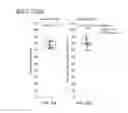 Fig. 13 - Combined sorting and concentrating particles in a microfluidic device