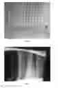 Fig. 02 - Method of inspecting a part using a marking template for radiography