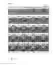 Fig. 15 - Device and method for detecting an analyte