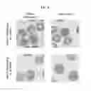 Fig. 09 - Multiphase systems for diagnosis of sickle cell disease