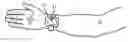 Fig. 01 - Magnetic Relaxometry to Assess Disease via Circulating Markers